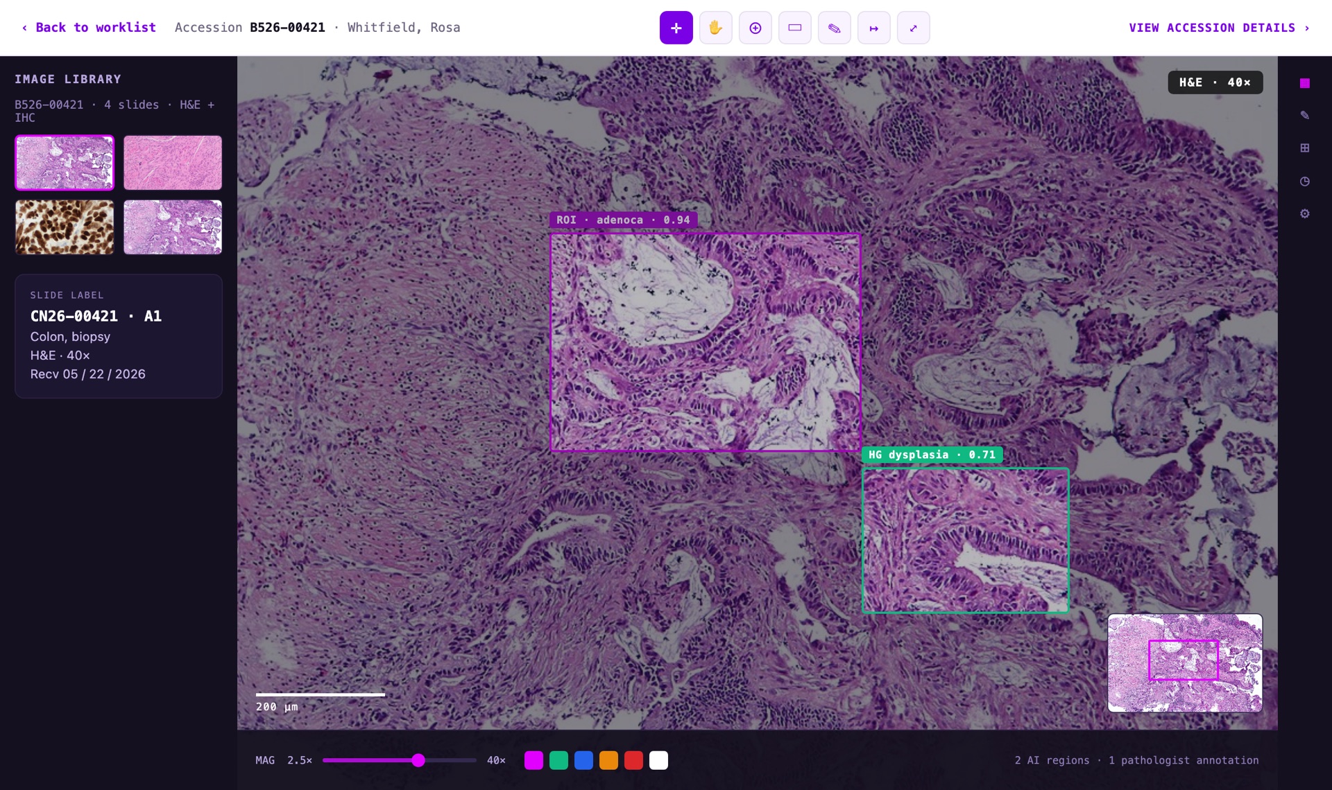 FlexLIS IMS — whole-slide viewer with AI regions of interest